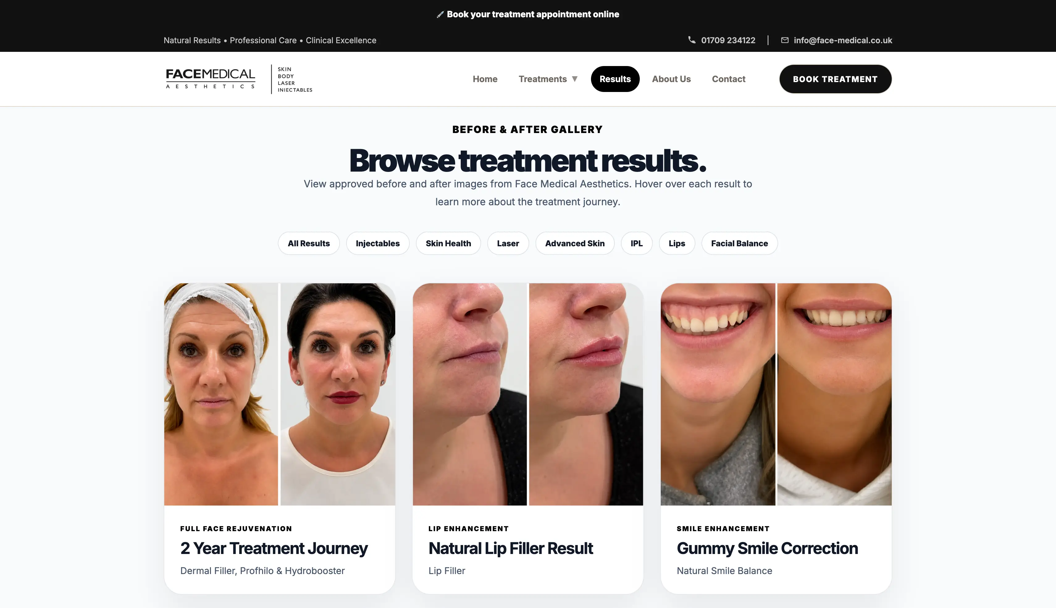 Face Medical Aesthetics treatment page result